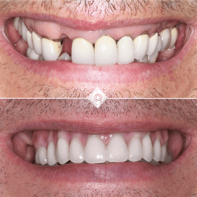 Before & After C. Fisher (2)-1