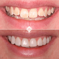 J. Dutton Before & Afters